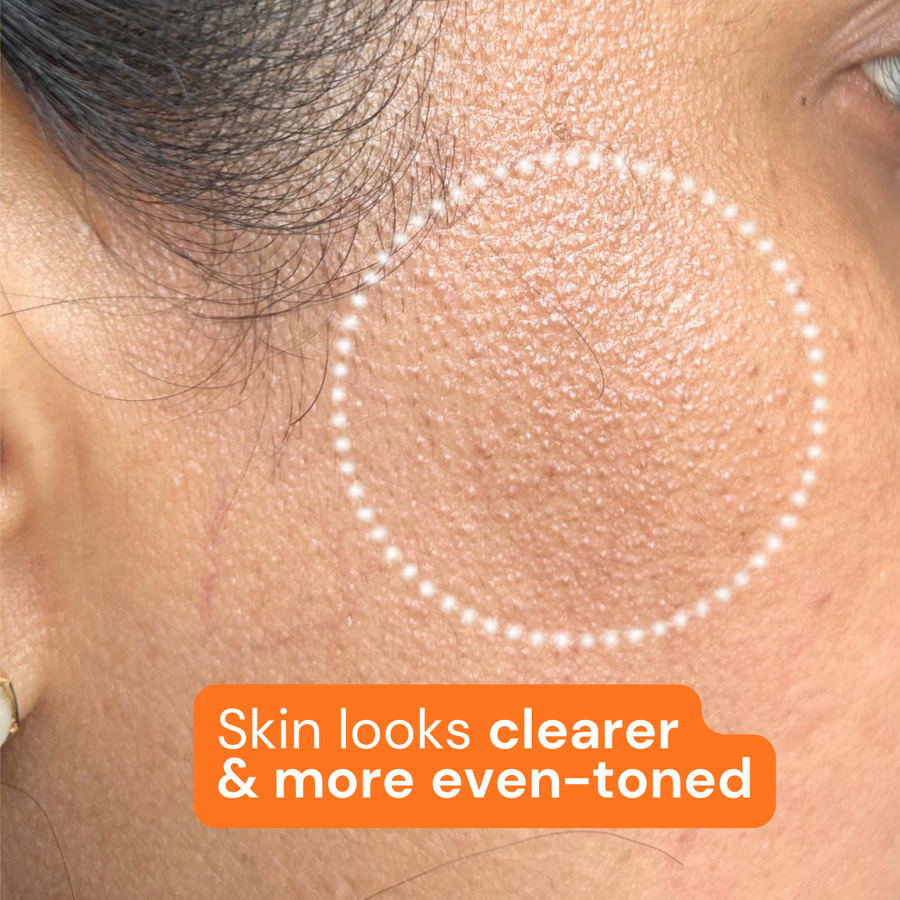 After using Titru product