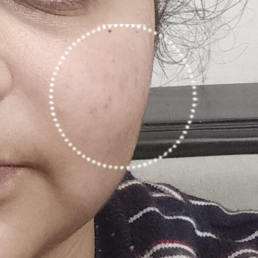 Before using Titru product