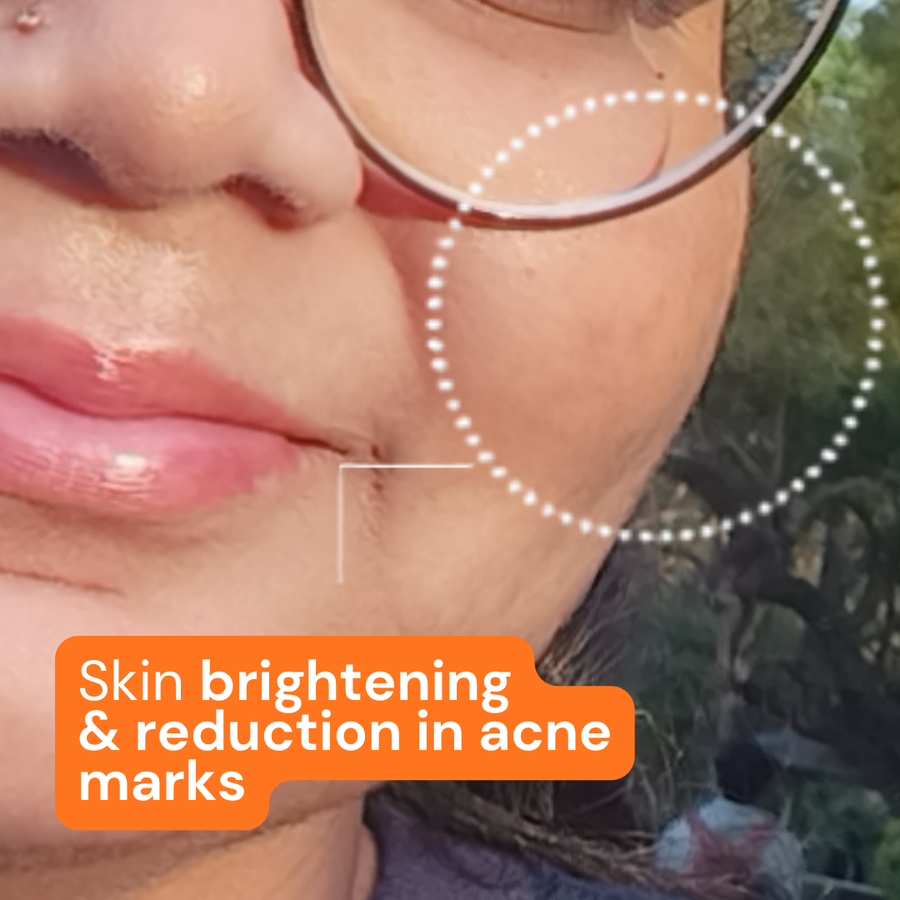 After using Titru product