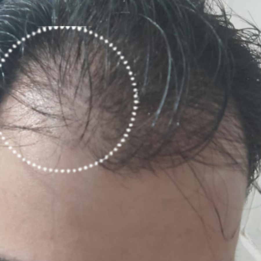Before using Titru product