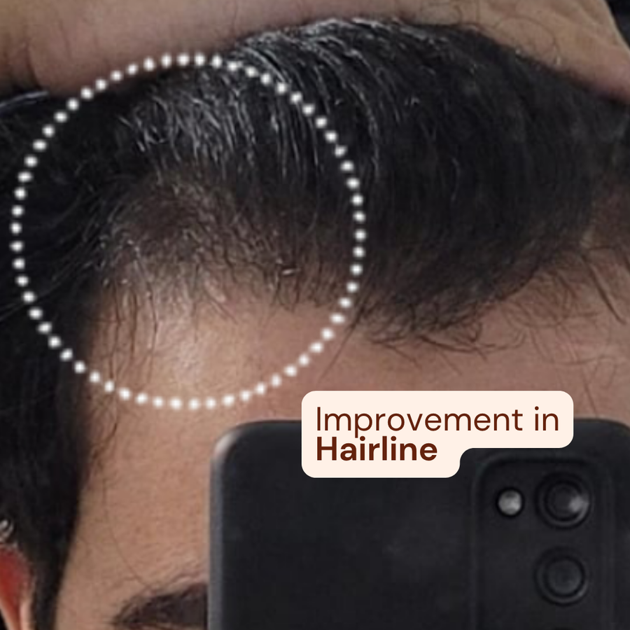 After using Titru product