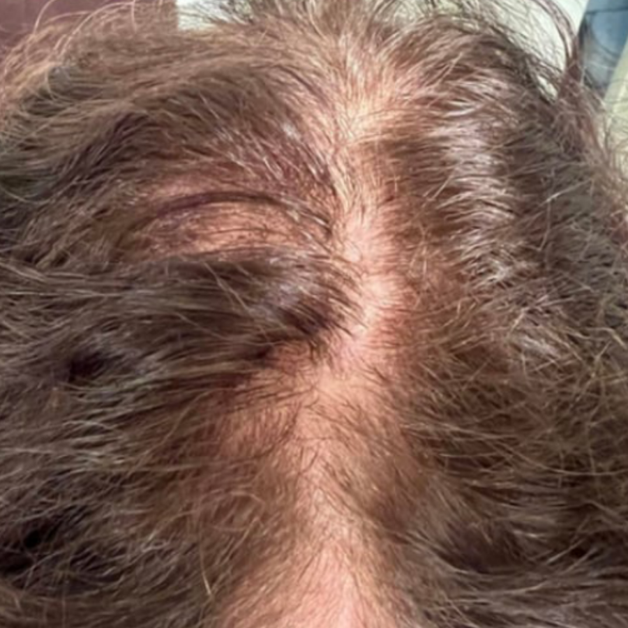 Before using Titru product