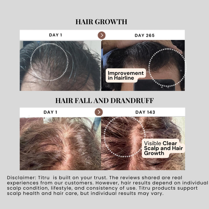 Titru Scalp Oil