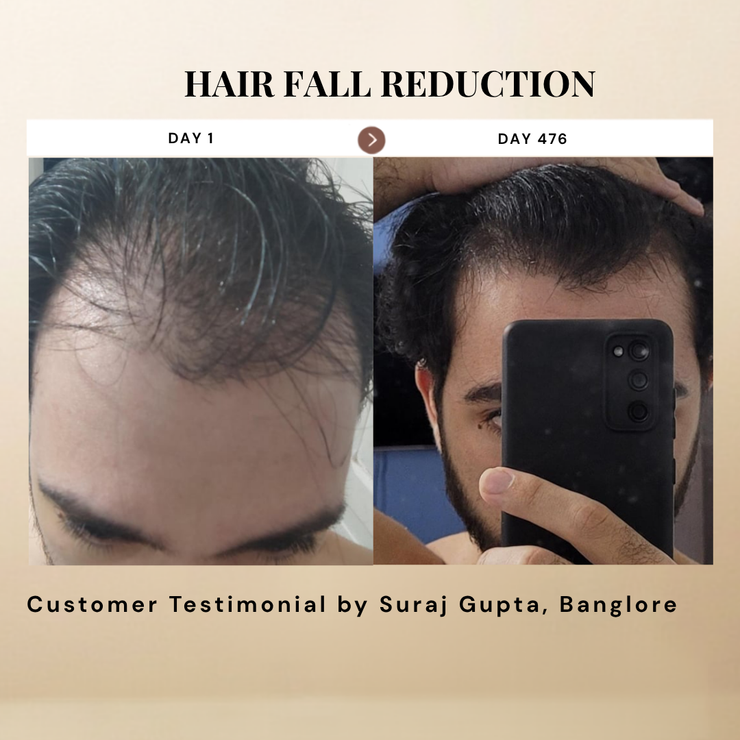 Titru Scalp Oil ingredients and benefits