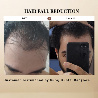 Titru Scalp Oil ingredients and benefits